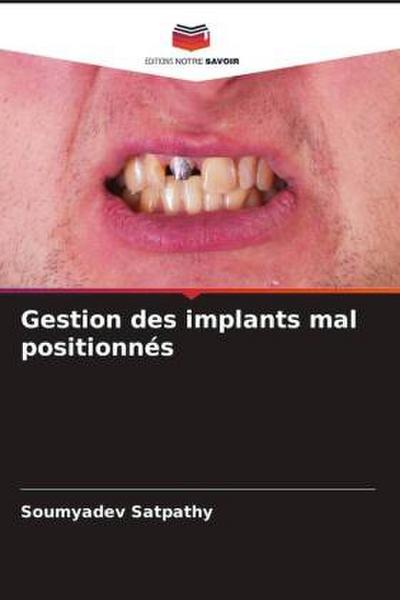 Gestion des implants mal positionnés