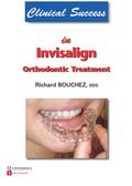 Clinical Success in Invisalign Orthodontic Treatme