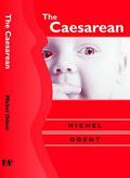 Caesarean