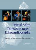 Mitral Valve Transesophageal Echocardiography