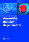Age-related macular degeneration