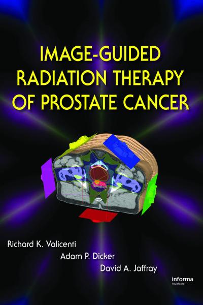 Image-Guided Radiation Therapy of Prostate Cancer