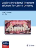 Guide to Periodontal Treatment Solutions for Gener