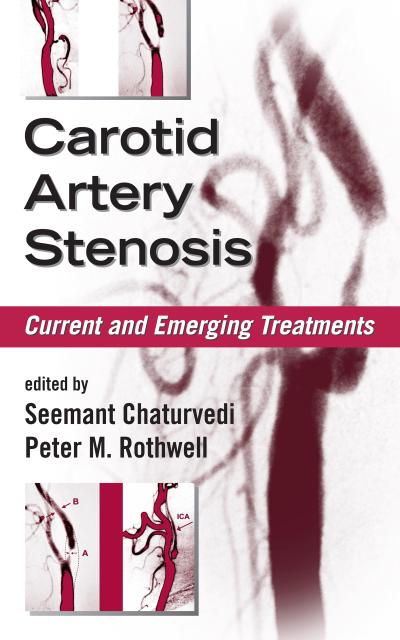 Carotid Artery Stenosis