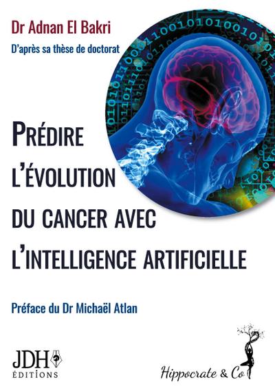 Prédire l’évolution du cancer avec l’intelligence artificielle