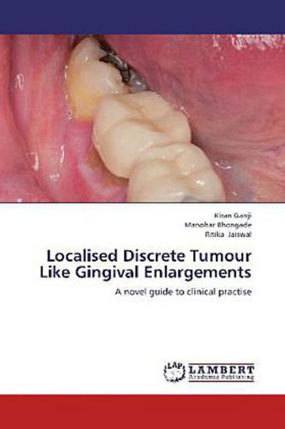 Localised Discrete Tumour Like Gingival Enlargements