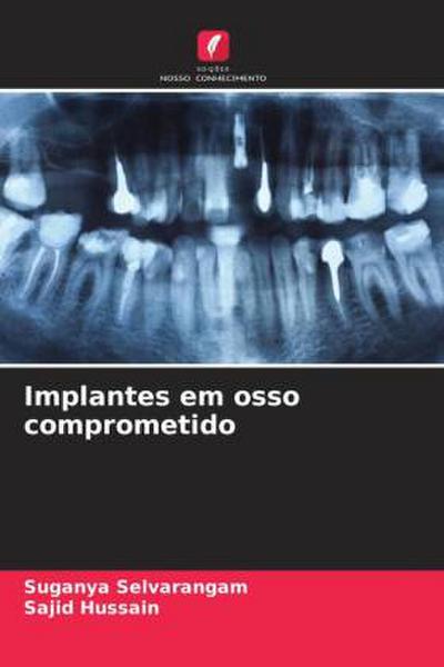 Implantes em osso comprometido