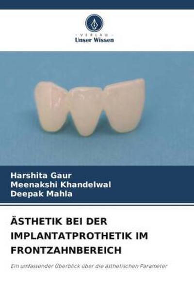 ÄSTHETIK BEI DER IMPLANTATPROTHETIK IM FRONTZAHNBEREICH