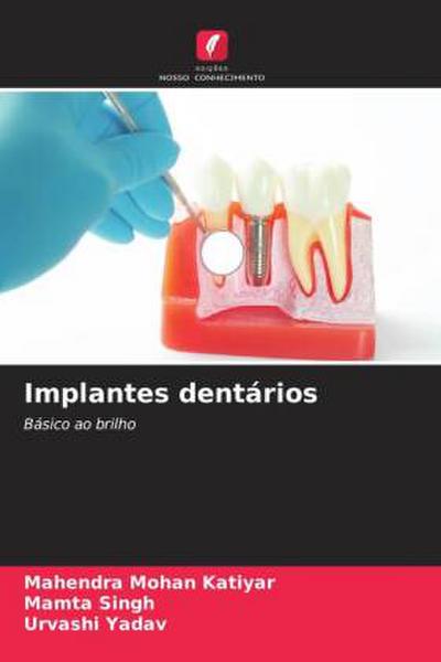 Implantes dentários
