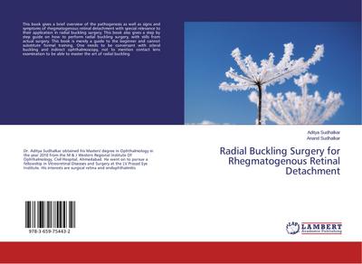 Radial Buckling Surgery for Rhegmatogenous Retinal Detachment