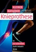 Kleiner Ratgeber Knieprothese