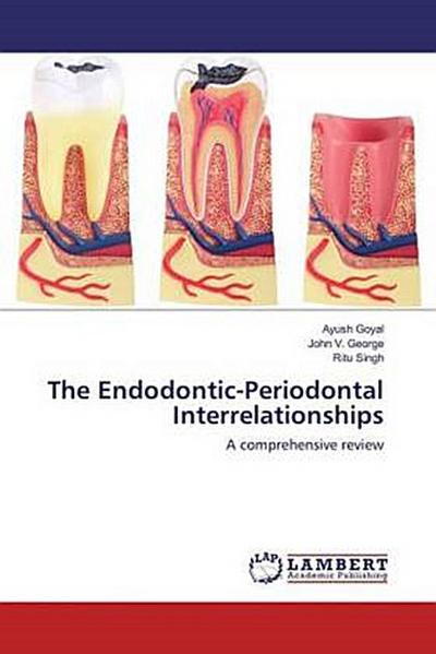 The Endodontic-Periodontal Interrelationships