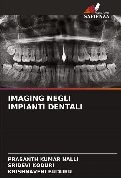 IMAGING NEGLI IMPIANTI DENTALI