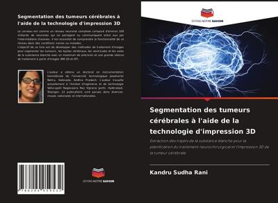 Segmentation des tumeurs cérébrales à l’aide de la technologie d’impression 3D