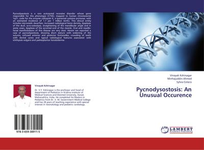 Pycnodysostosis: An Unusual Occurence
