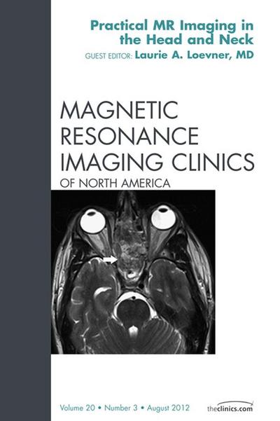 Head and Neck MRI, An Issue of Magnetic Resonance Imaging Clinics