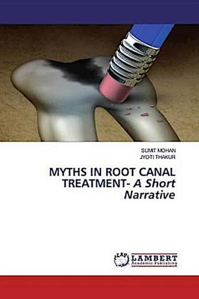 Myths in Root Canal Treatment - A Short Narrative