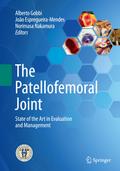 The Patellofemoral Joint