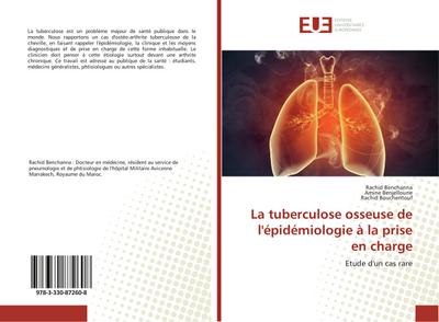 La tuberculose osseuse de l’épidémiologie à la prise en charge