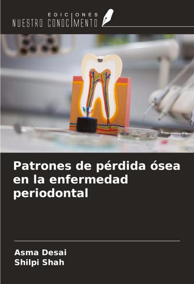 Patrones de pérdida ósea en la enfermedad periodontal