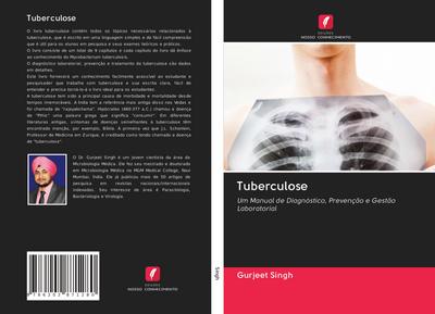 Tuberculose