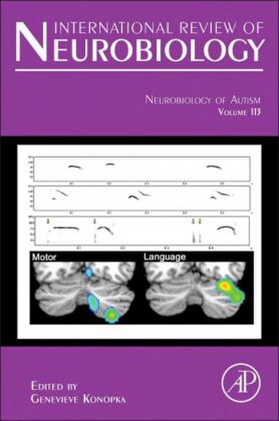 Neurobiology of Autism