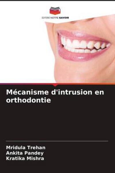 Mécanisme d’intrusion en orthodontie