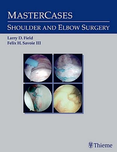 Master Cases, Shoulder and Elbow Surgery
