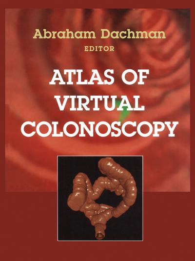 Atlas of Virtual Colonoscopy