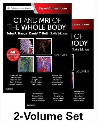 CT and MRI of the Whole Body, 2 Vols.