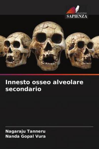 Innesto osseo alveolare secondario
