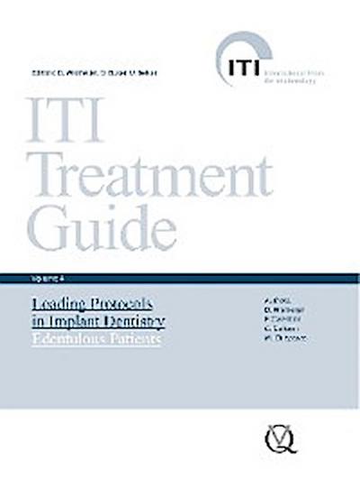 Loading Protocols in Implant Dentistry