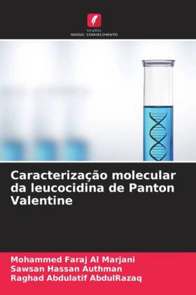 Caracterização molecular da leucocidina de Panton Valentine