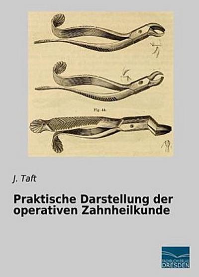 Praktische Darstellung der operativen Zahnheilkunde