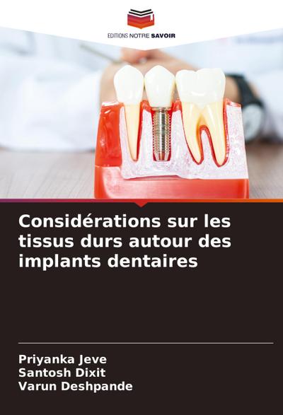 Considérations sur les tissus durs autour des implants dentaires