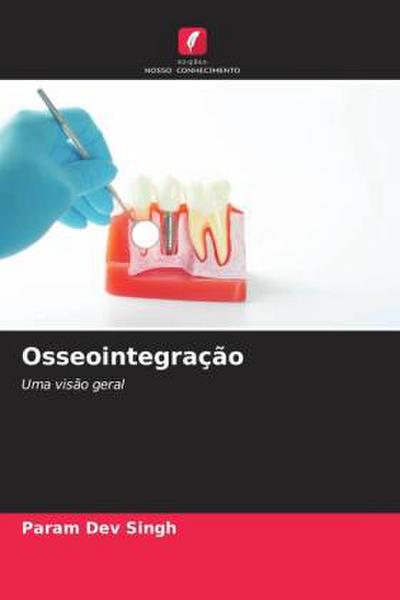 Osseointegração