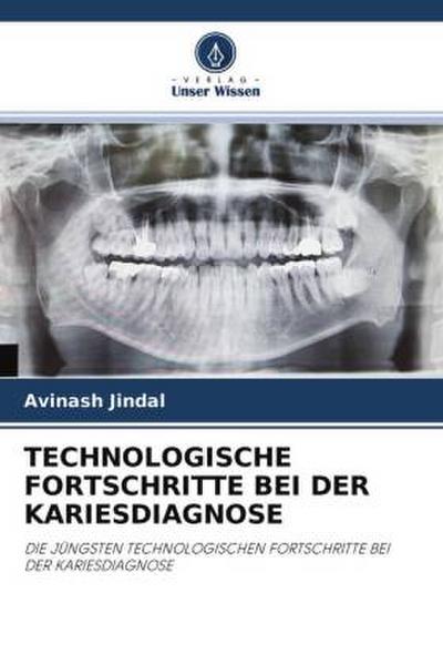TECHNOLOGISCHE FORTSCHRITTE BEI DER KARIESDIAGNOSE