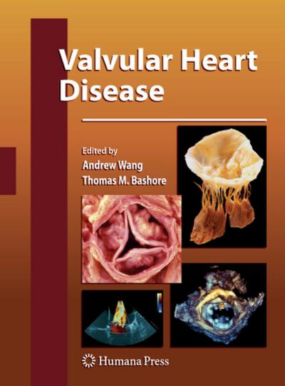 Valvular Heart Disease