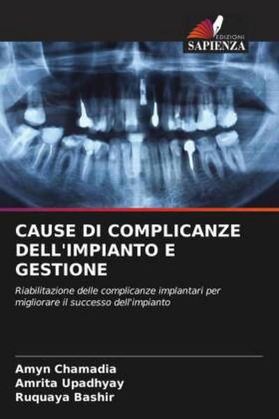 CAUSE DI COMPLICANZE DELL’IMPIANTO E GESTIONE