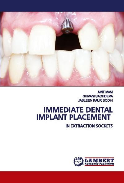 IMMEDIATE DENTAL IMPLANT PLACEMENT