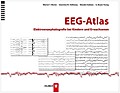 EEG-Atlas