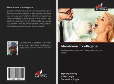 Membrana di collagene