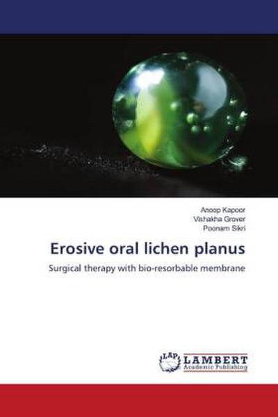 Erosive oral lichen planus