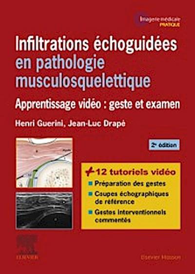 Infiltrations echoguidees en pathologie musculosquelettique