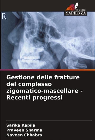 Gestione delle fratture del complesso zigomatico-mascellare - Recenti progressi