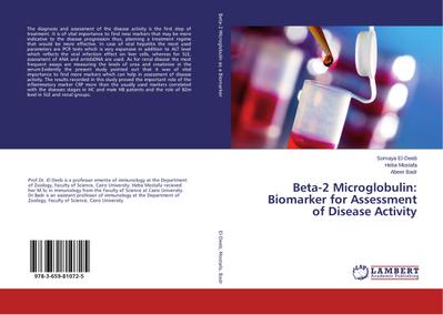 Beta-2 Microglobulin: Biomarker for Assessment of Disease Activity