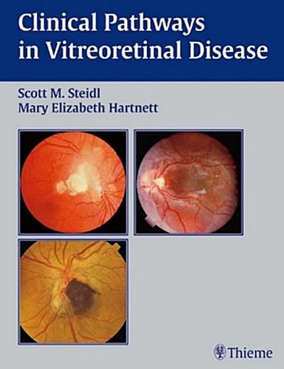 Clinical Pathways in Vitreoretinal Diseases
