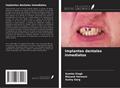 Implantes dentales inmediatos