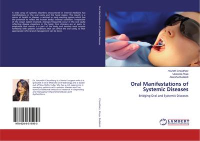 Oral Manifestations of Systemic Diseases