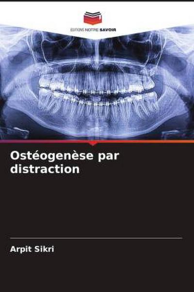 Ostéogenèse par distraction
